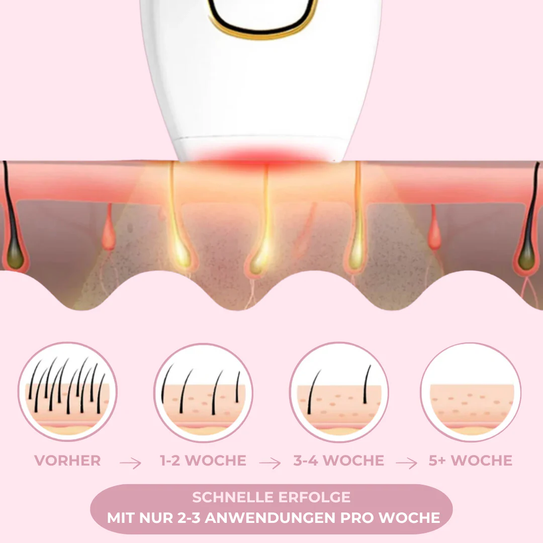 GLIMORA® - IPL Haarentfernung
