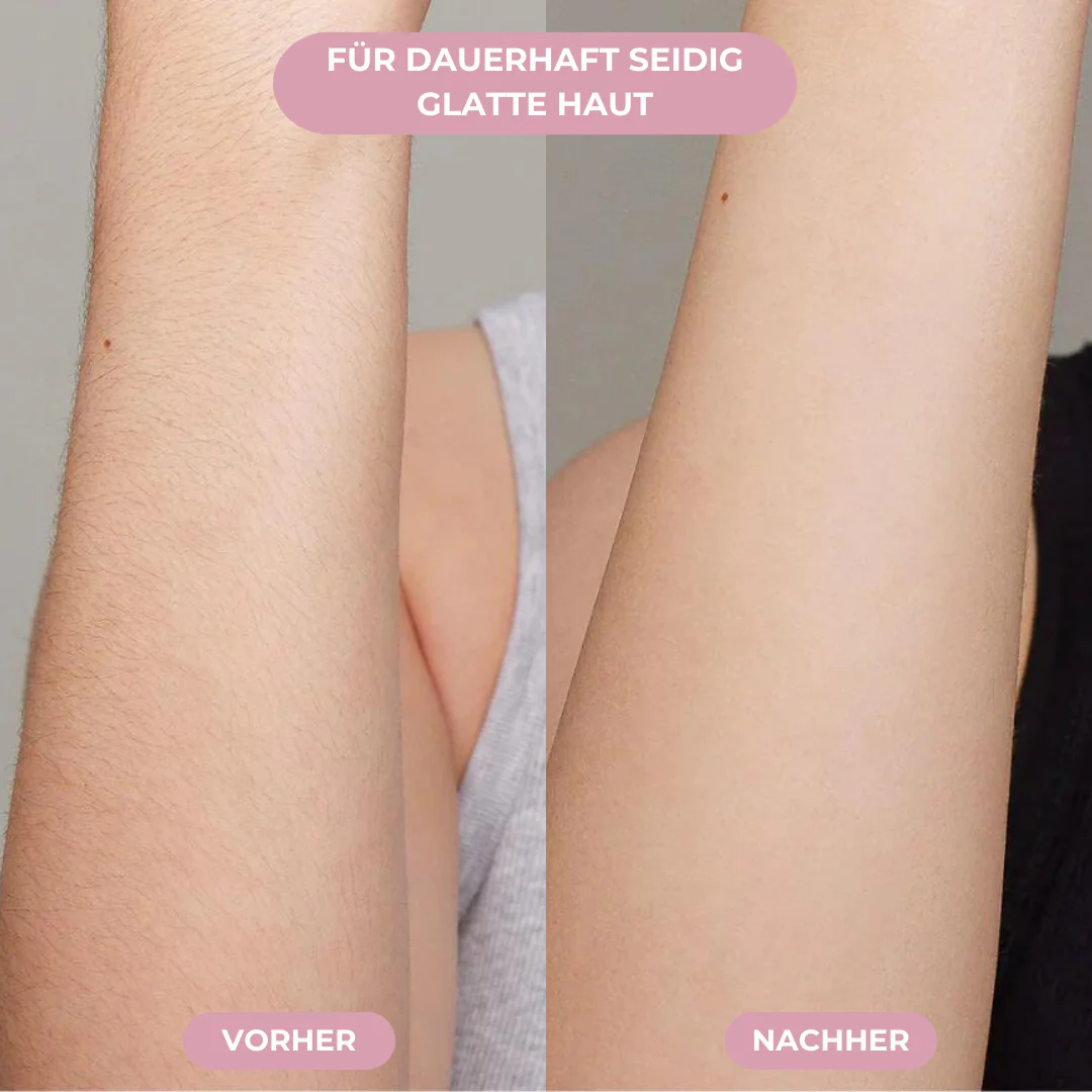 GLIMORA® - IPL Haarentfernung