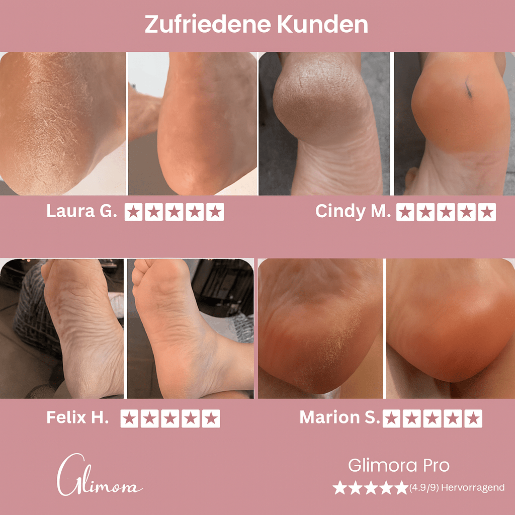 GLIMORA®  - Hornhautentferner Pro