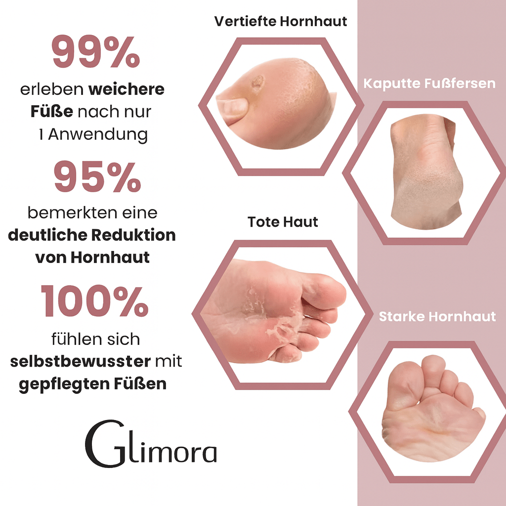 GLIMORA®  - Hornhautentferner Pro